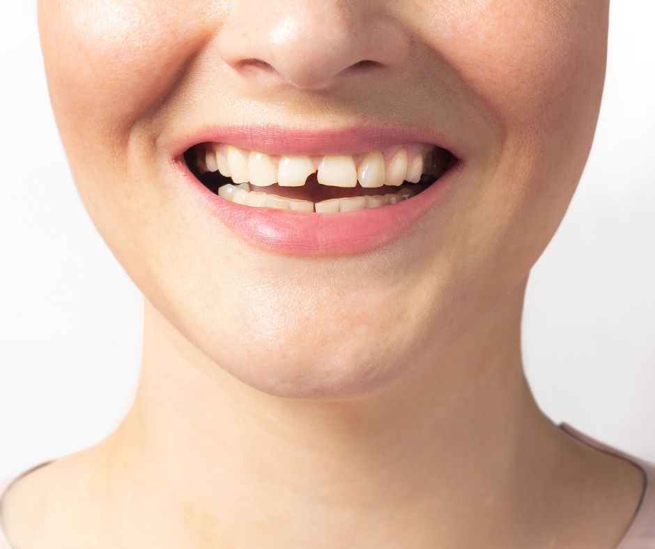 Hero Pediatric Dentistry - Emergency Pediatric Dentist Near Me