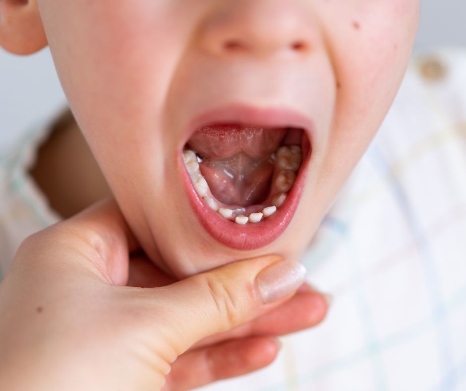 Hero Pediatric Dentistry - dental care Herndon VA