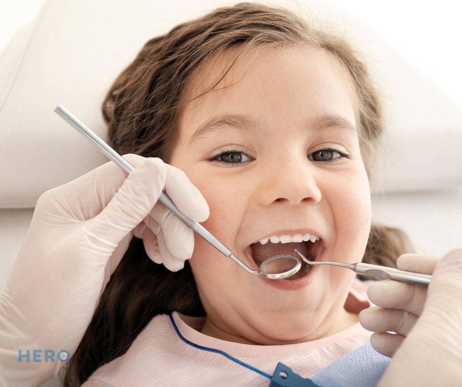 Hero Pediatric Dentistry - mamelons on teeth